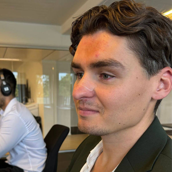 Næsestrips og Stressreduktion